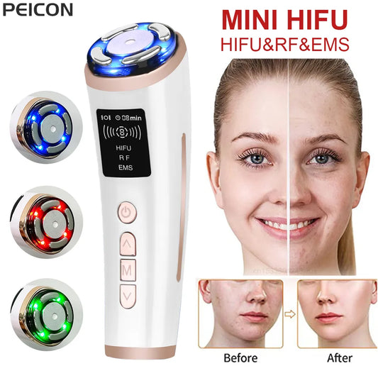 Hifu Face Lifting Mini Hifu Facial Radio Frequency Machine